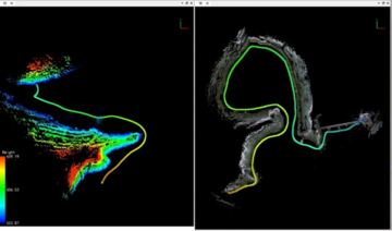3dscan1-5